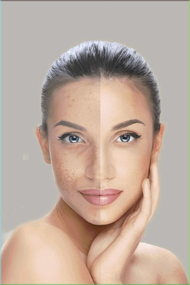 المدونة,مقالات,مقالات طبيه,طب تجميلي,تجميل
