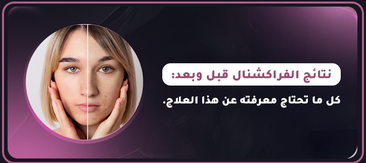 المدونة,مقالات,مقالات طبيه,طب تجميلي,تجميل