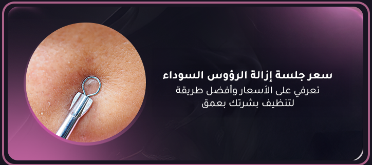 سعر جلسة إزالة الرؤوس السوداء