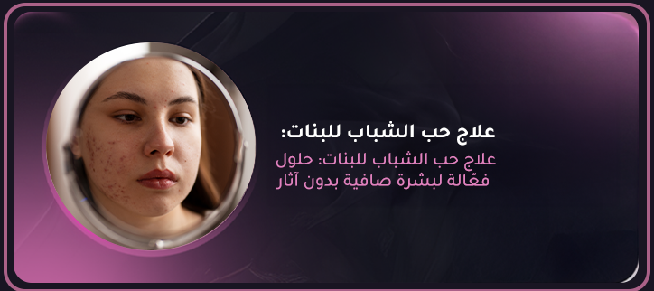علاج حب الشباب للبنات