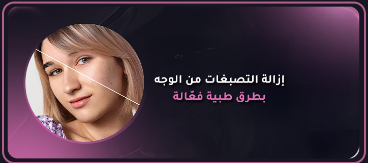 إزالة التصبغات من الوجه